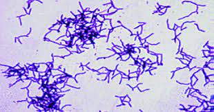 Anaerobic Infections Actinomycosis