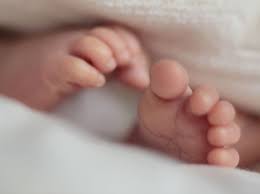 Thickening of the tendon sheaths frequently is present, especially of the tibialis posterior and peroneal sheaths. Why Are My Baby S Feet Turned In And How Can It Be Corrected Madeformums