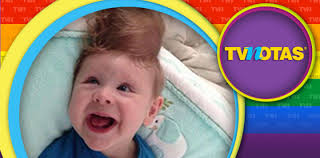 Nació con el cerebro fuera del cráneo ¡y ha sobrevivido 7 meses!