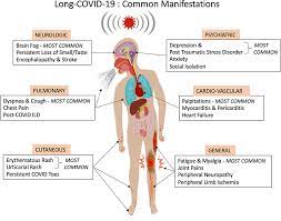 Every day, someone in the united kingdom and. The Conundrum Of Long Covid 19 A Narrative Review Ijgm