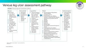 Consensus Recommendations Simplifying Venous Leg Ulcer