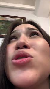 back to when i had no braces 😬 #tiktokphilippines #foryoupage #xybza