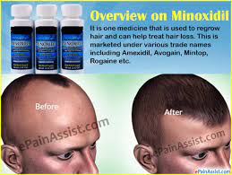 The follicle would then enter a dormant phase in the cycle (temporarily) while the matrix is restructured for future growth, hopefully with a thicker and stronger hair shaft. Can Minoxidil Regrow Hair
