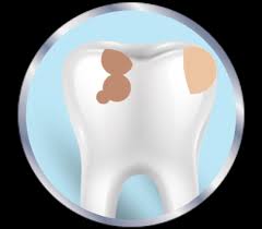 Here's what you need to know. Is It A Cavity Or Sensitive Teeth Sensodyne