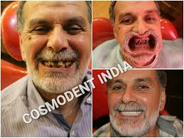 We did not find results for: Full Mouth Dental Implants In India Cosmodent India