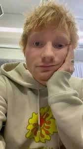 A fan told me that am ugly is that true😔😔