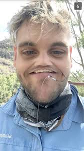 Gruesome fish hook accident