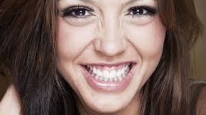 Can botox fix a gummy smile? How To Fix A Gummy Smile Wilkinson Orthodontics