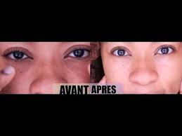 Appliquez Ce Masque Sur Vos Cernes Et Faites Les Disparaitre Incroyables Resultats Youtube Comment Eclaircir Ses Yeux Eclaircir Ses Yeux Cernes