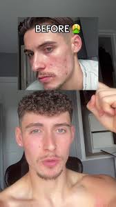 Shilajit Before and After Face