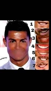 I keep loosing matches 😪what could be the problem...