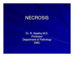 You can use graph paper to measure your room (with a scale where ¼ inch. Necrosis