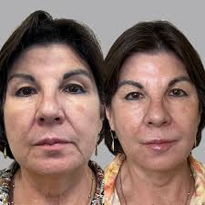 Glow Medical Spa (@glowmedspa.co) • Instagram photos and videos