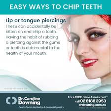 Caroline Downing (DrDowningDental)