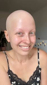 Completely me before and after 🩷, #alopecia #alopeciauniversalis #hairloss  #wigs #hairlosssolution #humanhairwigs #hairlossjourney #grwm  #alopeciaareata #hairregrowth #makeuptransformation ...