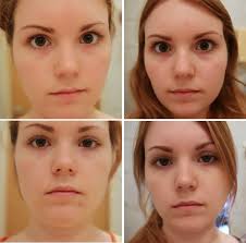 Sylvia ist 71 jahre, pensioniere lehrerin und hat an sich schon immer besonderen wert auf ihr äußeres gelegt. Chamy At Be Happy Be Charming Review La Roche Posay Effaclar Duo