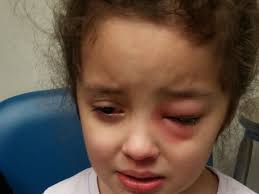 Fundraiser for Abigail Alvarez by HoneyBear Rapp : Healing and Help for  Elodie