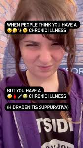 Hello! Since my last post, i've gotten quite a few messages from people  asking about triggers and what mine are! Triggers are certain aspects that  “trigger” flares and outbreaks of your illness.