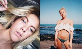 Instagram / peg parnevik vis mer. Philippa Parnevik Uppmarksammade Kvinnodagen Med Nakenbild Still Not Asking For It Metro Mode
