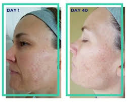 Copy of Reviews and Real Results