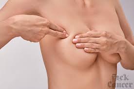 What Does Breast Cancer Feel Like what does breast cancer feel like