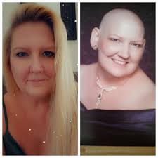 Good morning everyone, this is Kelly. I was released from the hospital  yesterday after they placed my port where my chemo will be administered. I  start my chemo tomorrow. I wanted to