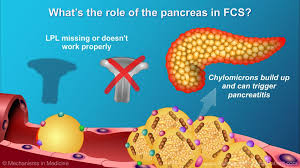 Pin On Animated Pancreas Patient