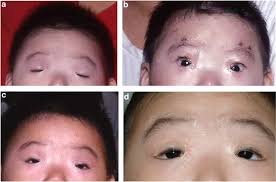 Image result for Blepharis transvaalensis