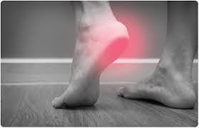 The signs and symptoms of bone cancer in children vary from bone to bone. Plantar Fasciitis Symptoms And Diagnosis
