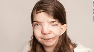 La belleza interior de una persona con malformación física