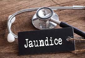 Diet Chart For Jaundice Patient Foods To Eat Avoid