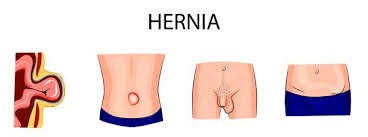 We did not find results for: Relax Or You Ll Give Yourself A Hernia Breaking Muscle