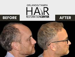 The Bassin Center...