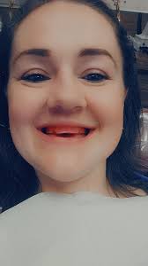 Improving smile with new dentures?