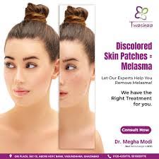 Megha Modi's Instagram, Twitter & Facebook