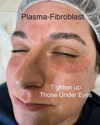 SkinWorks (@skinworks.tn) • Instagram photos and videos