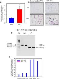 1 eur = mdl 21,671. Mir 146a Deficiency Accelerates Hepatic Inflammation Without Influencing Diet Induced Obesity In Mice Scientific Reports