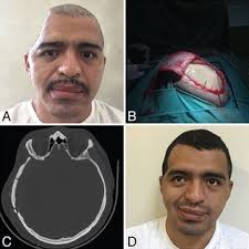 Everardo GARCIA-ESTRADA