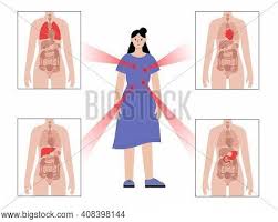 Maybe you would like to learn more about one of these? Pain Internal Organs Vector Photo Free Trial Bigstock