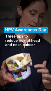 Today is HPV Awareness Day. There are more than 100 strains of HPV and some  types of the virus can cause cancer. About 60% to 70% of head and neck  cancers are linked to HPV.⁠, ⁠, Dr. Katharine Price, ...