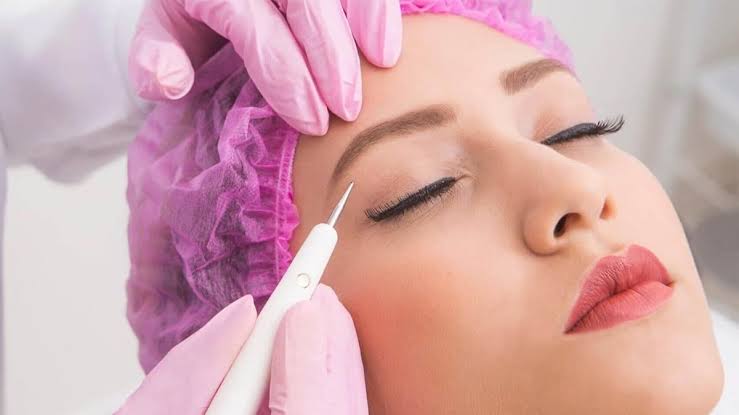 Plasma Pen Treatment for Under Eye Wrinkles - 7 Dimensions Medical Centre
