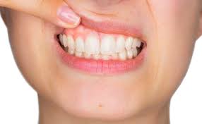 How is gum disease treated? Gum Health 101 Know How To Keep Your Gums Healthy