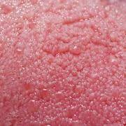 How To Get Rid Of White Bumps On The Side Of Your Tongue Livestrong Com Sore On Tongue Remedy Canker Sore On Tongue Tongue Sores