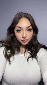 My last AviClear treatment! #3 #esthetician #horrorstory #scary #dobet...