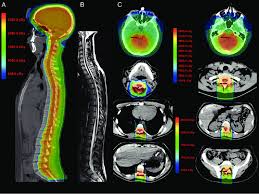 Typically, color washing is applied over a solid paint color, though other techniques involving color washing have recently emerged. Sagittal Ct Planning Images With Colorwash Dose Distribution For An Download Scientific Diagram