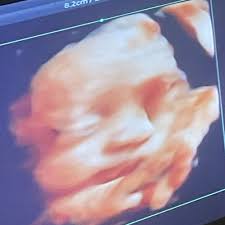 Restore Pdx Portland, OR