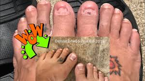 Unfollow acrylic toe nail to stop getting updates on your ebay feed. Toe Nail Extreme Transformation Dual Forms White Tip White Moon Acrylic Toenails Youtube