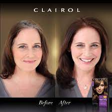 5 out of 5 stars. Before After Agedefy Colorexperts Clairol Hair Color Vidal Sassoon Hair Color Wash Out Hair Dye
