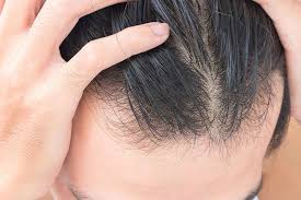 Hair grows everywhere on the human skin except on places like the palms of our hands and the soles of our feet, our eyelids and belly buttons, but many hairs are so fine they're virtually invisible. 5 Root Causes Of Hair Thinning And What To Do About It Ds Healthcare Group