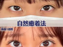 ASTRA BEAUTY CLINIC（アストラビューティクリニック）